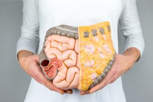 Mulher segurando um modelo de intestinos na frente do corpo | Conheça as doenças intestinais mais comuns